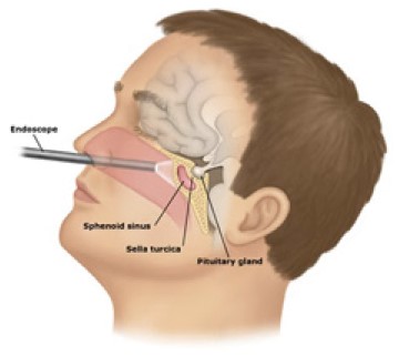 Pituitary Gland Illustration