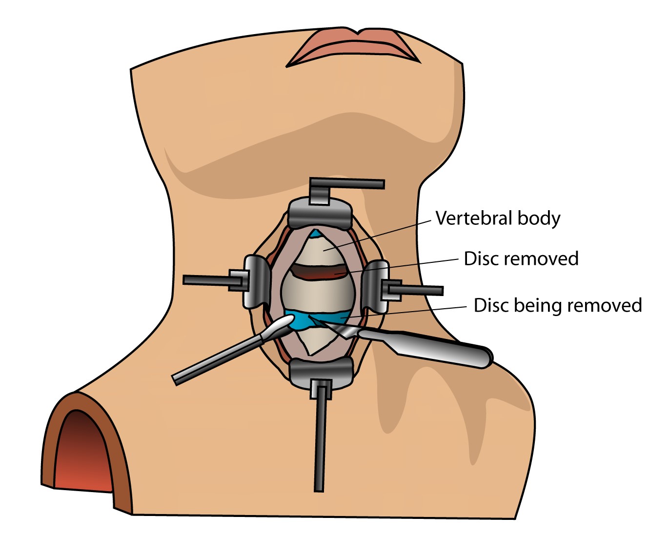 Pituitary Gland Illustration