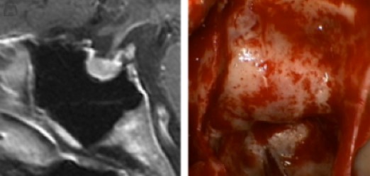 Pituitary Gland Illustration